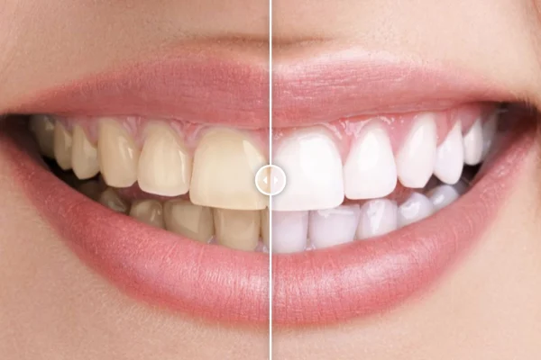 Before & After Images Comparison plugin banner with a slider dividing two images